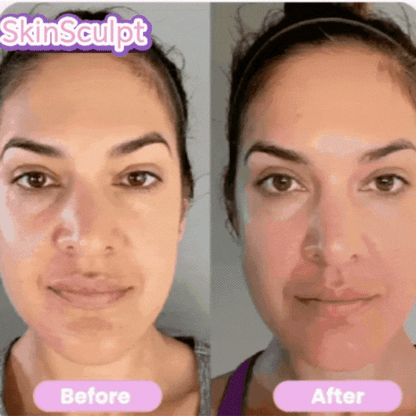 SkinSculpt kit profecional