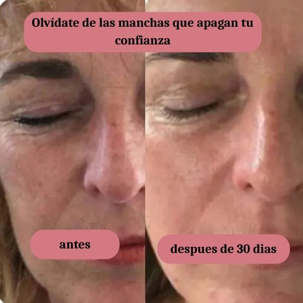 SkinSculpt kit profecional